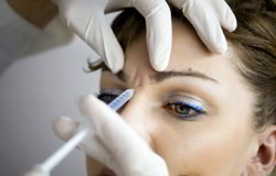botox