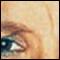 botox