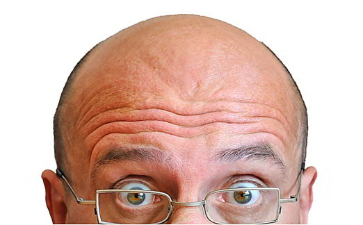 greffe de cheveux
