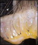 Sliver for follicular grafts